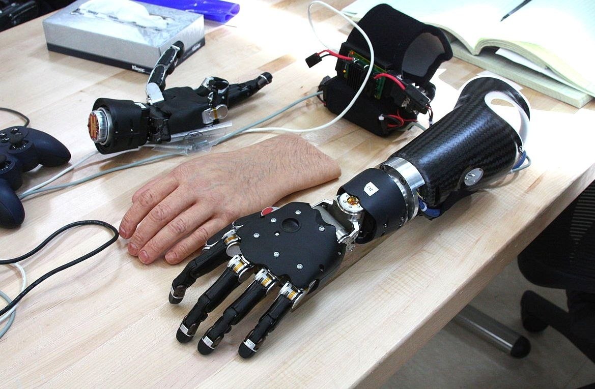 Самый дорогой протез. Touch Bionics протезы. Bebionic протезы. Touch Bionics протез кисти. Нейробионика протезы.