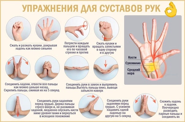 Узлы на пальцах рук как лечить