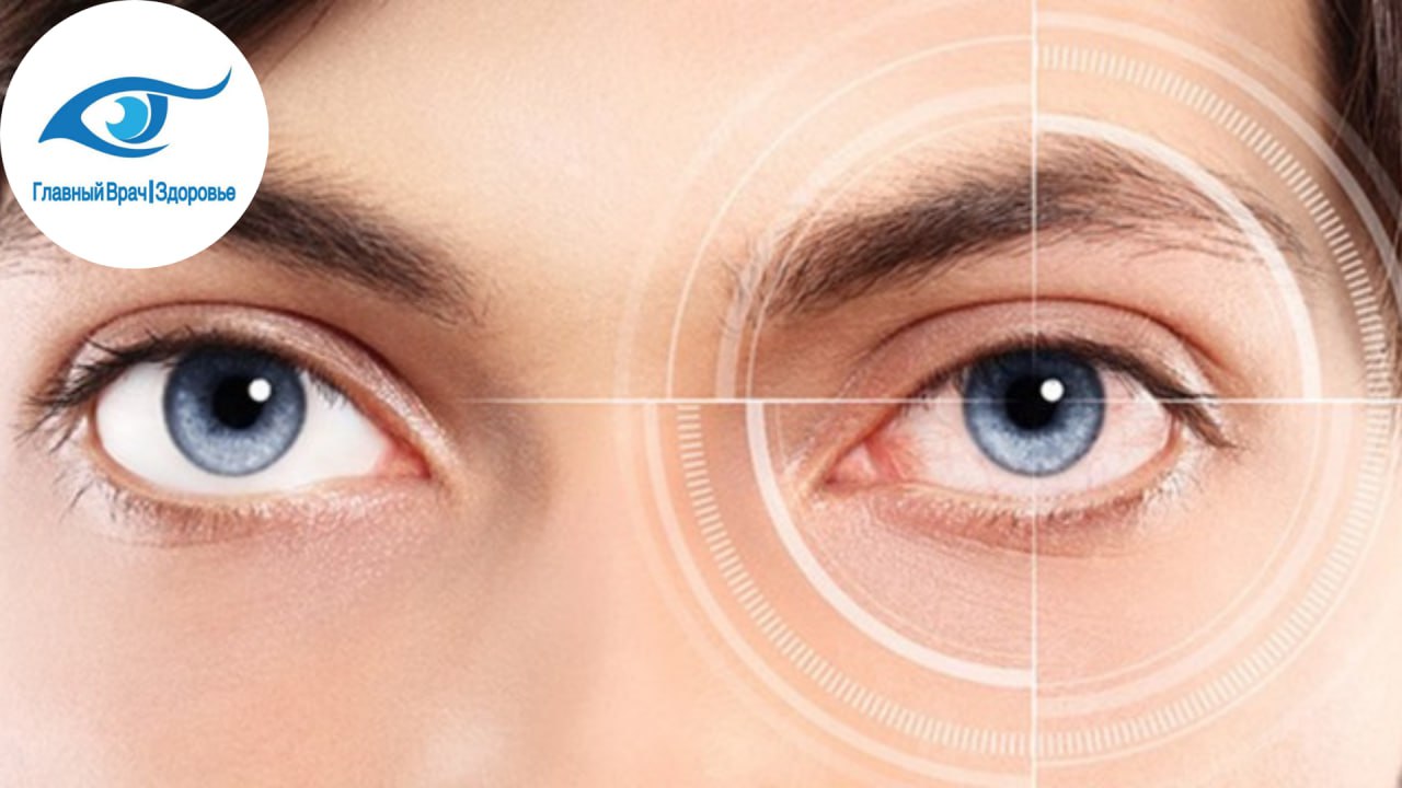 Глазное зрение 1. Роговичный астигматизм. Астигматизм -3. Здоровые глаза.
